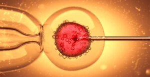 Read more about the article Key Aspects Impacting Progress and Failures of the IVF