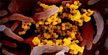 Addressing the Ws of RT-PCR for SARS-CoV-2